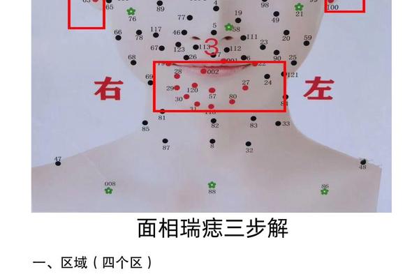 脖子痣相女大全图片(全身痣相图片大全图解)