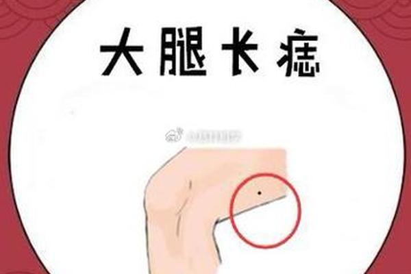 腿窝痣相(腿上痣图片大全图解) 腿窝痣相(腿上痣图片大全图解)