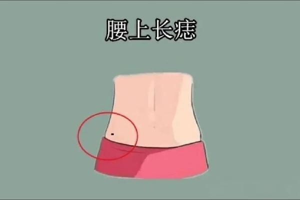 腰部上方长痣痣相(长痣的位置和命运)