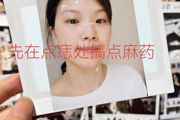 相城哪里除痣好_去痣的最好方法