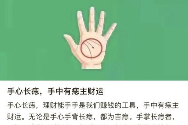 双鱼座痣相解读-手上为什么会长鱼痣图片