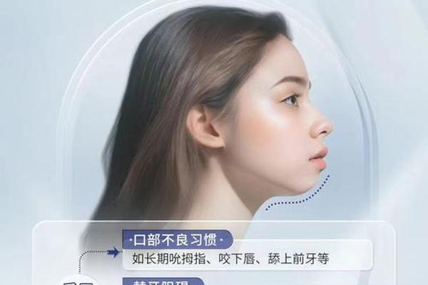 小美团队痣相美学-meyerson痣是啥意思