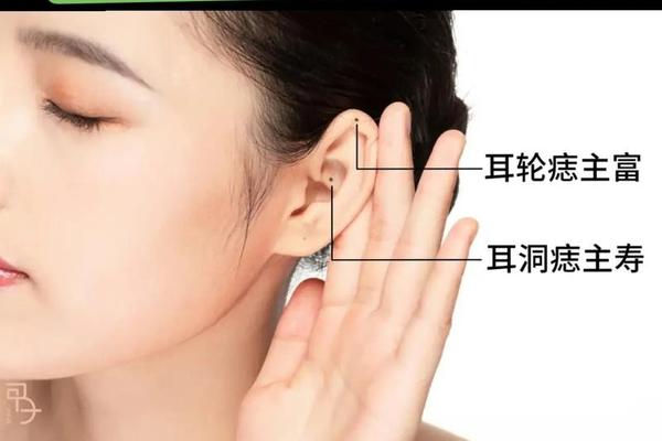 耳朵痣相的科学解释 耳朵上的痣命相图解