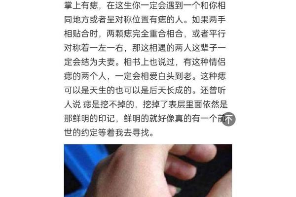 痣相痣右手男—右手突然长痣是什么意思