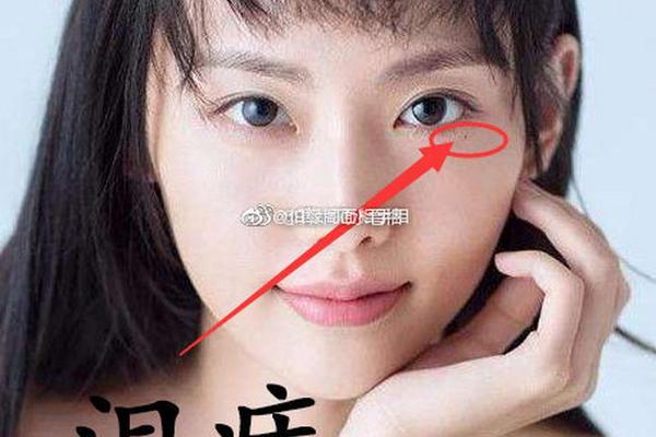 哭夫痣是好痣相、女人有哭夫痣代表什么