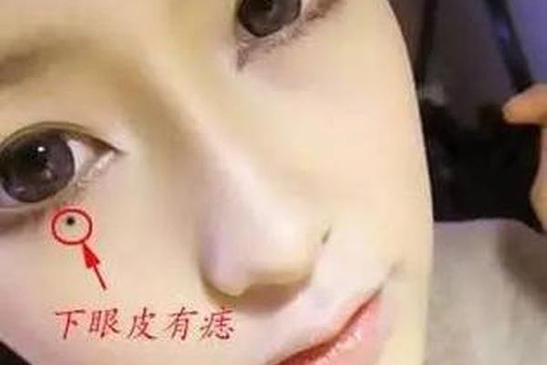 眼角长颗痣苛夫相在线、女人右眼角有痣克夫 眼角长颗痣苛夫相在线、女人右眼角有痣克夫