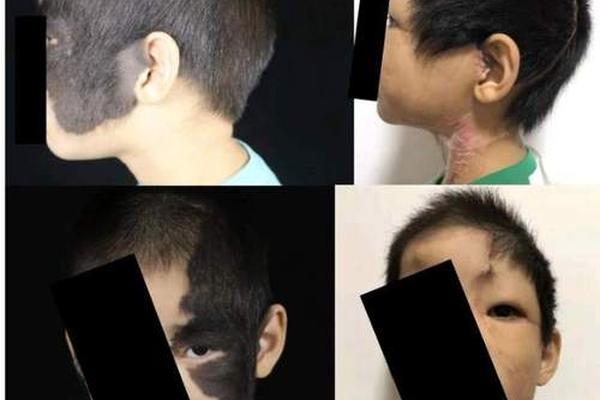 痣相男的蛋上两个黑痣,蛋蛋上长黑色的黑痣
