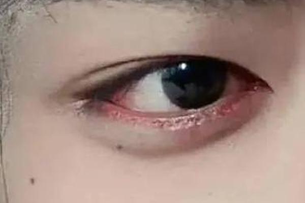 眼相卧蚕有痣,男人眼下卧蚕面相