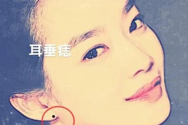 人有佛保佑的痣相(有佛保佑的人的症状)