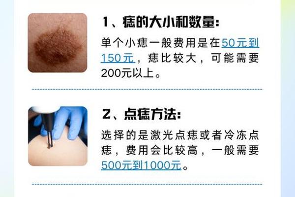 相城点痣价格-点痣50元一颗贵吗