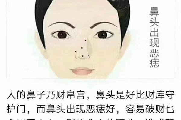 痣相鼻子上长痣 鼻子上长痣的人 痣相鼻子上长痣 鼻子上长痣的人