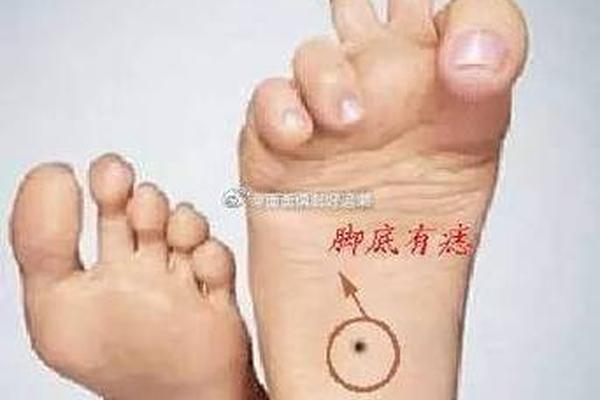脚底痣相算命图解—痣相男人脸部痣相图解