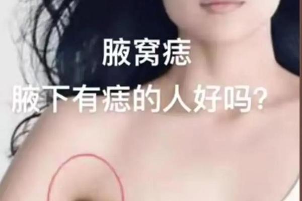 肩膀上痣相-腋下痣相图解