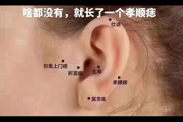 女人左耳朵痣相最准图_女人左耳轮廓有痣图解