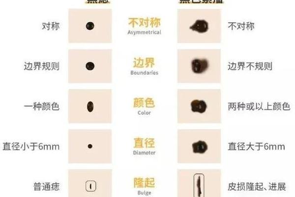 痣颜色种类 相、痣的种类图片及名称