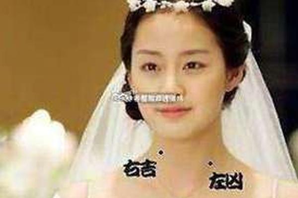 相痣图解脖子-脖子侧面痣代表什么