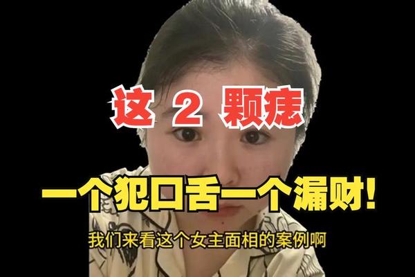 痣相口舌是什么意思？、口舌痣能不能点掉