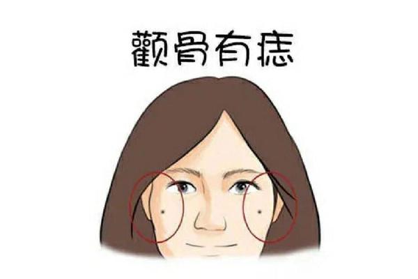 颧骨周围痣相_颧骨位置长痣
