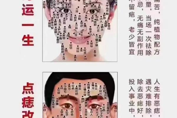痣相和八字哪个优先、痣相看命运可信吗