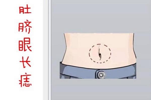 痣相肚脐眼围长痣好不好;肚脐眼痣相代表什么