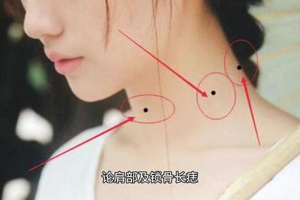 痣相肩膀下面有痣(痣相大全图解)