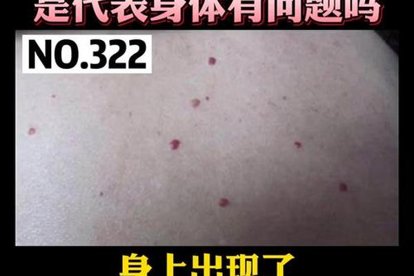 男下臂内侧红痣相-男人小手臂内侧有痣
