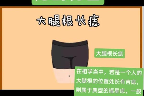 大腿根窝有痣相、男人大腿根部有痣图解