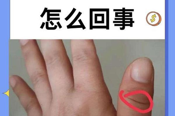 拇指关节上的痣相 拇指上有几个关节