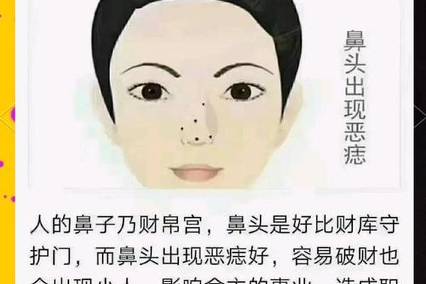 鼻孔中间痣相 鼻子中间痣相图解大全