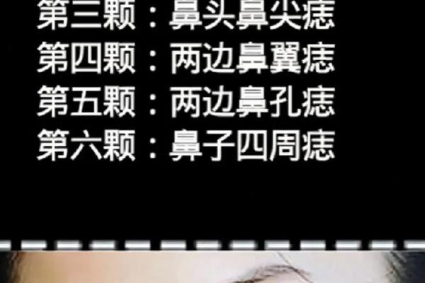 脸上痣相代表什么—鼻子痣相图解