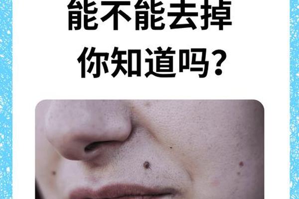 嘴唇上的痣相最准图,嘴唇上的痣可以去掉吗