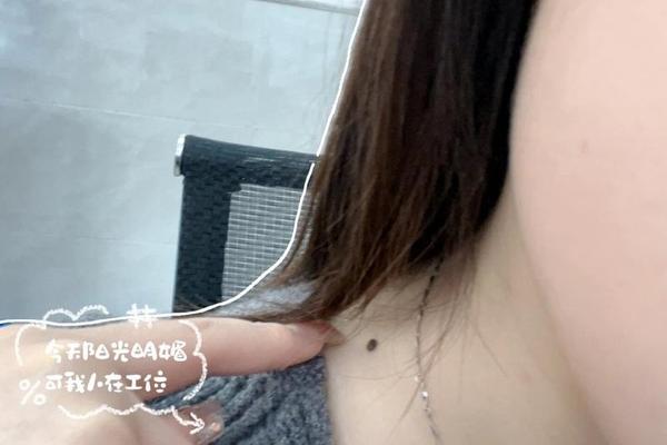 左脖痣相;脖子左边的痣图解大全