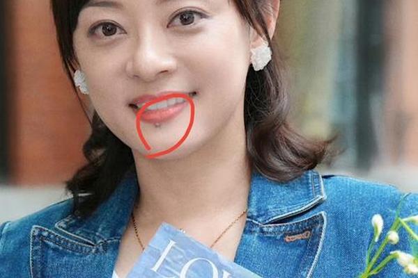 女子嘴巴旁边的痣相_嘴唇下面有痣的女人代表什么