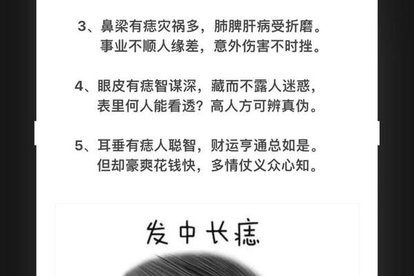 痣相少奴是什么意思-妨母痣代表什么