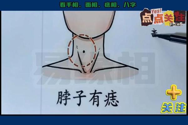 手上的痣相代表什么-脖子上有痣代表什么