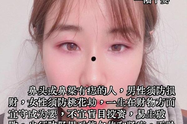 观相鼻子点痣图片大全;鼻子哪个位置的痣最好
