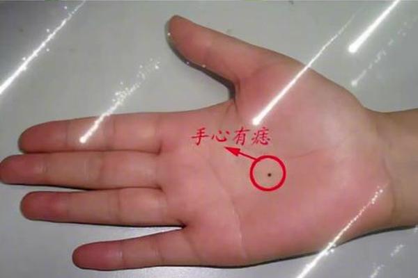 手指有痣相 右手中指长痣代表什么