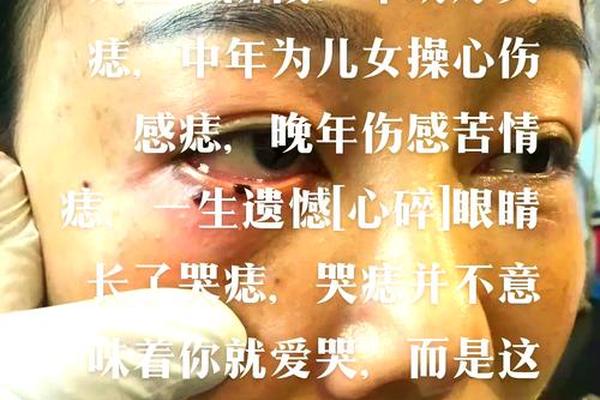 女人滴泪痣相;女人有滴泪痣代表什么
