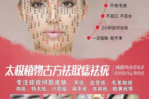 女人鼻子有痣相什么—女人鼻梁左侧有痣