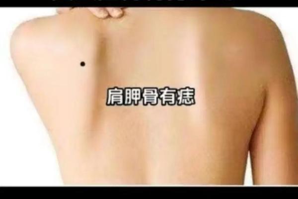 痣相女人背痣相图解 背痣的位置与命运图解女