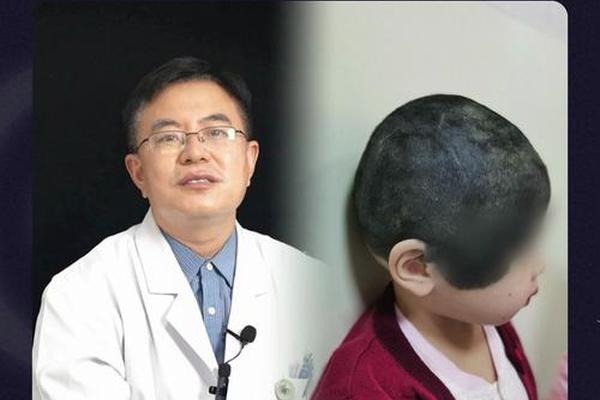 宝宝头发里有痣相—左侧头发里有痣图解