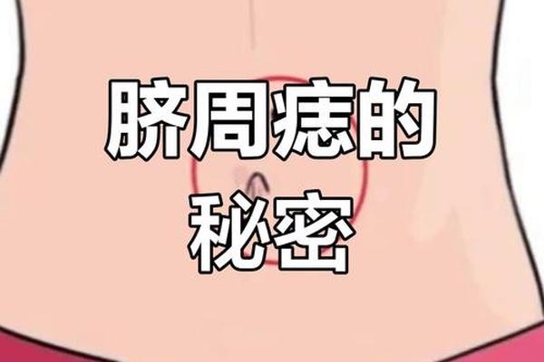肚脐上长痣的富相—肚脐上面有痣代表什么