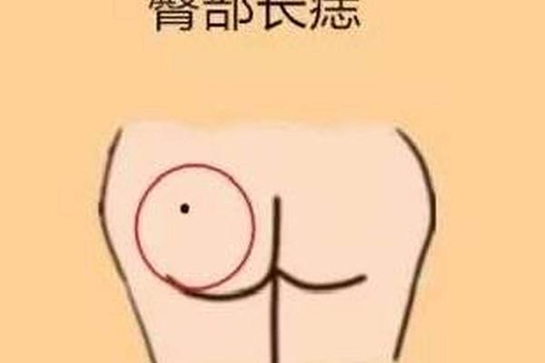 福地痣相;屁股痣相图解10大福痣