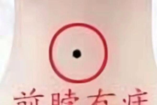 麻衣神相脖子上的痣,麻衣神相 痣