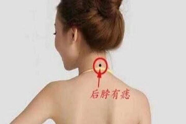 温柔的痣相 后脖子有痣图解