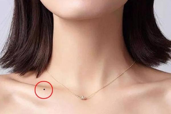 痣相解说锁骨;锁骨上的痣图解大全 女性