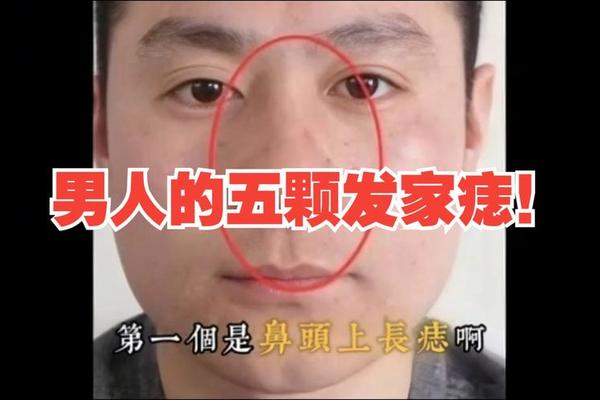 痣相到底是谁搞的 有痣者事竟成