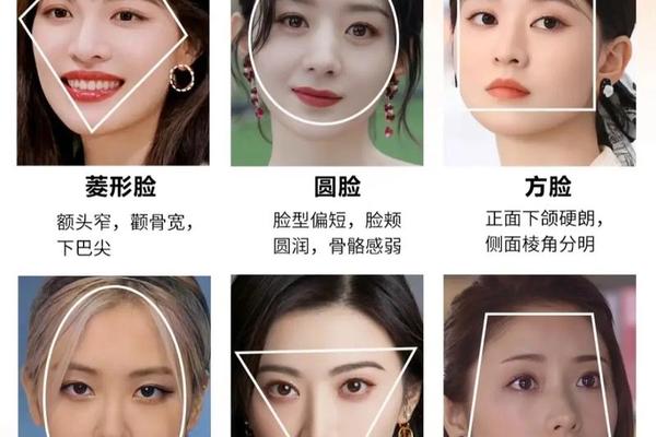 颧骨痣相解析—颧骨比额头宽是啥脸型