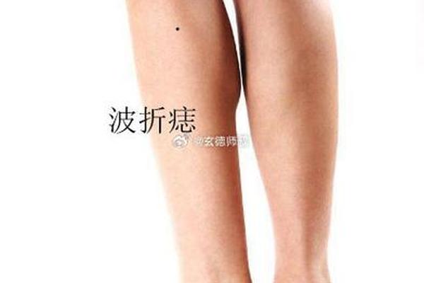 男人腿部痣相—腿上痣图片大全图解