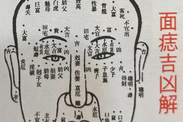 痣相医学解释 面相痣解析